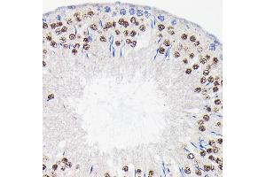 Immunohistochemistry of paraffin-embedded rat testis using PI3 Kinase p85 beta Rabbit mAb (ABIN1679407, ABIN3019246, ABIN3019247 and ABIN7101736) at dilution of 1:100 (40x lens). (PIK3R2 antibody)