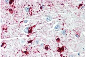 Human Brain, Cortex (formalin-fixed, paraffin-embedded) stained with CRYAB antibody ABIN462098 at 10 µg/ml followed by biotinylated goat anti-rabbit IgG secondary antibody ABIN481713, alkaline phosphatase-streptavidin and chromogen. (CRYAB antibody)