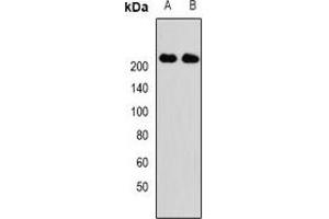Western blot analysis of KIF1B expression in Hela (A), SKOV3 (B) whole cell lysates. (KIF1B antibody)