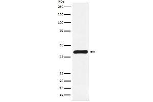 Western blot analysis of ALKBH1 expression in Jurkat cell lysate. (Recombinant ALKBH1 antibody)
