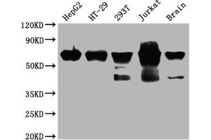 Western Blot Positive WB detected in: HepG2 whole cell lysate, HT-29 whole cell lysate, 293T whole cell lysate, Jurkat whole cell lysate, Mouse brain tissue All lanes: DDX5 antibody at 1:2000 Secondary Goat polyclonal to rabbit IgG at 1/50000 dilution Predicted band size: 70, 61 kDa Observed band size: 70 kDa (Recombinant DDX5 antibody)