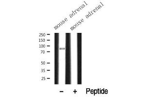 Western blot analysis of extracts of mouse adrenal? (SIK1 antibody  (Internal Region))