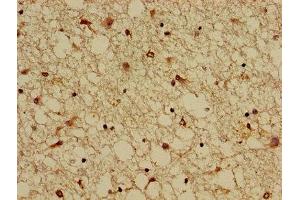 Immunohistochemistry of paraffin-embedded human brain tissue using ABIN7146577 at dilution of 1:100 (DREAM antibody  (AA 1-145))