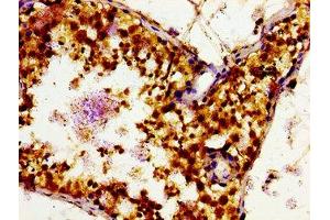 Immunohistochemistry of paraffin-embedded human testis tissue using ABIN7160161 at dilution of 1:100 (SLC16A12 antibody  (AA 431-486))
