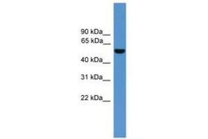 Image no. 1 for anti-Aldehyde Dehydrogenase 9 Family, Member A1 (ALDH9A1) (AA 351-400) antibody (ABIN6746619) (ALDH9A1 antibody  (AA 351-400))