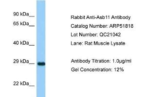 Western Blotting (WB) image for anti-Ankyrin Repeat and SOCS Box-Containing 11 (ASB11) (N-Term) antibody (ABIN2784641)