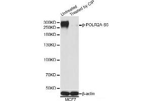 POLR2A/RPB1 antibody  (pSer5)