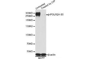 Western blot analysis of extracts of MCF7 cells using Phospho-POLR2A(S5) Polyclonal Antibody at dilution of 1:1000. (POLR2A/RPB1 antibody  (pSer5))