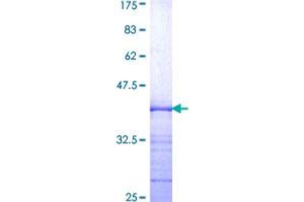 Aryl Hydrocarbon Receptor Protein (AHR) (AA 721-820) (GST tag)