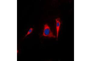 Immunofluorescent analysis of 14-3-3 gamma staining in A431 cells. (14-3-3 gamma antibody  (Center))