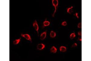 ABIN6266753 staining HeLa by IF/ICC. (MUTYH antibody  (Internal Region))