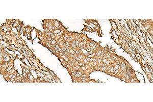 UBE2A antibody