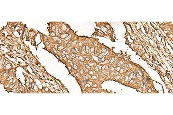 UBE2A antibody