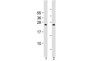 Western blot testing of human 1) cerebellum and 2) spleen tissue lysate with Grancalcin antibody at 1:2000. (Grancalcin antibody  (AA 19-53))