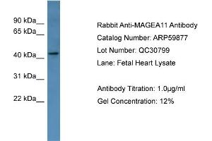 WB Suggested Anti-MAGEA11  Antibody Titration: 0. (MAGEA11 antibody  (Middle Region))