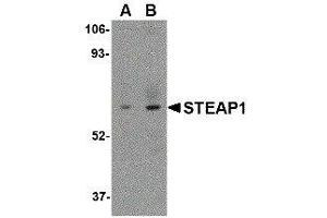 Western Blotting (WB) image for anti-Six Transmembrane Epithelial Antigen of The Prostate 1 (STEAP1) (C-Term) antibody (ABIN2476601) (STEAP1 antibody  (C-Term))