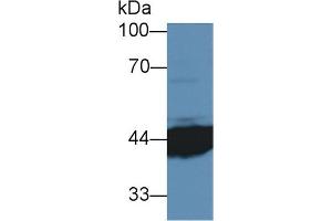 Detection of IL3Ra in Human MCF7 cell lysate using Polyclonal Antibody to Interleukin 3 Receptor Alpha (IL3Ra) (IL3RA antibody  (AA 167-331))