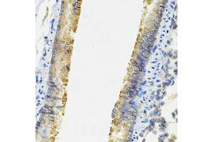 Immunohistochemistry of paraffin-embedded rat lung using ACSS2 Antibody (ABIN6292756) at dilution of 1:100 (40x lens).