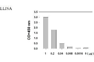 Image no. 6 for Epidermal Growth Factor Receptor (EGFR) ELISA Kit (ABIN1981783)