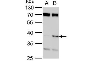 WB Image SET antibody, isoform 2-specifc detects SET protein by western blot analysis.