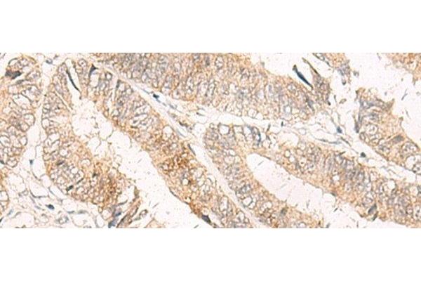 TRAPPC1 antibody