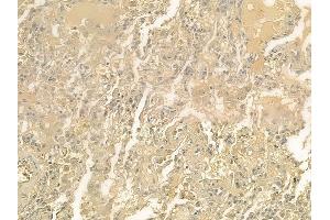 ABIN6258597 and ABIN6274827 at 1/100 staining human normal lung tissue by IHC-P.