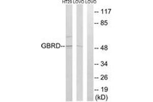 Western blot analysis of extracts from LOVO/HT-29 cells, using GABRD Antibody. (GABRD antibody  (AA 141-190))