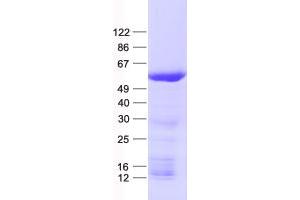 Validation with Western Blot