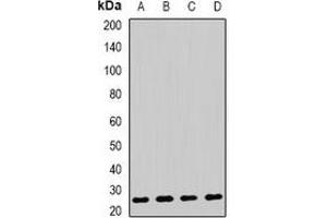 Western blot analysis of AK4 expression in HepG2 (A), Raji (B), mouse liver (C), mouse kidney (D) whole cell lysates. (AK4 antibody)