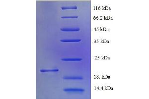 SDS-PAGE (SDS) image for Muscarinic Acetylcholine Receptor M1 (CHRM1) (AA 210-366), (Cytoplasmic Domain), (Cytosolic) protein (His tag) (ABIN5709283) (CHRM1 Protein (AA 210-366, Cytoplasmic Domain, Cytosolic) (His tag))