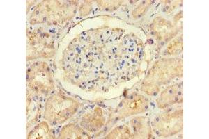 Immunohistochemistry of paraffin-embedded human kidney tissue using ABIN7174258 at dilution of 1:100 (USP14 antibody  (C-Term))