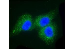 Immunofluorescent analysis of 4 % paraformaldehyde-fixed, 0. (F13A1 antibody  (AA 60-94))
