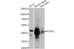 Western blot analysis of extracts of various cell lines, using PDHA2 antibody (ABIN6293729) at 1:1000 dilution. (PDHA2 antibody)