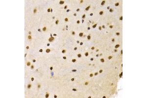 Immunohistochemistry of paraffin-embedded mouse brain using DNMT3A Antibody (ABIN1872325) at dilution of 1:100 (40x lens). (DNMT3A antibody)