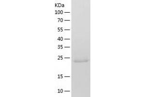 Western Blotting (WB) image for Thymidine Kinase 2, Mitochondrial (TK2) (AA 34-265) protein (His tag) (ABIN7284208) (TK2 Protein (AA 34-265) (His tag))
