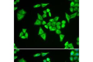 Immunofluorescence analysis of HeLa cells using ADSL Polyclonal Antibody (Adenylosuccinate Lyase antibody)