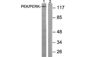 Western Blotting (WB) image for anti-Eukaryotic Translation Initiation Factor 2-alpha Kinase 3 (EIF2AK3) (Thr981) antibody (ABIN1848259) (PERK antibody  (Thr981))