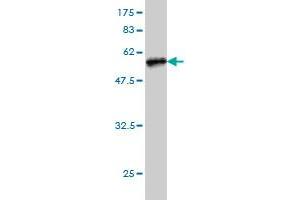 Western Blot detection against Immunogen (49. (TREM1 antibody  (AA 21-234))