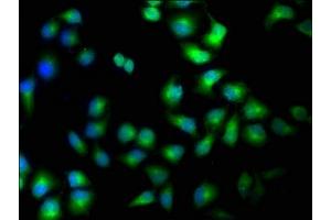 Immunofluorescence staining of Hela cells with ABIN7169187 at 1:100, counter-stained with DAPI. (TAO Kinase 1 (TAOK1) (AA 400-659) antibody)