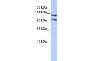 WB Suggested Anti-RBM5 Antibody Titration:  0. (RBM5 antibody  (N-Term))