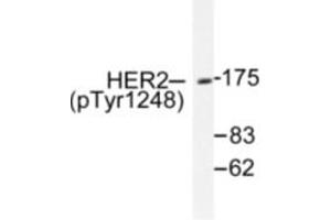 Image no. 1 for anti-Receptor tyrosine-protein kinase erbB-2 (ErbB2/Her2) (pTyr1248) antibody (ABIN318037) (ErbB2/Her2 antibody  (pTyr1248))