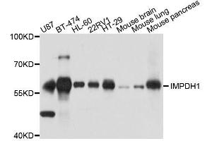 Western blot analysis of extracts of various cell lines, using IMPDH1 antibody. (IMPDH1 antibody  (AA 434-563))
