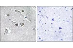 Immunohistochemistry analysis of paraffin-embedded human brain tissue, using Collagen XI alpha2 Antibody.