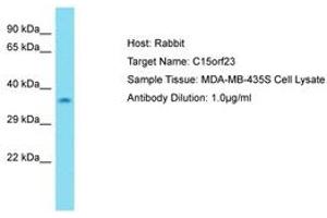 Image no. 1 for anti-Kinetochore-Localized Astrin/SPAG5 Binding Protein (KNSTRN) (AA 31-80) antibody (ABIN6750720) (KNSTRN antibody  (AA 31-80))