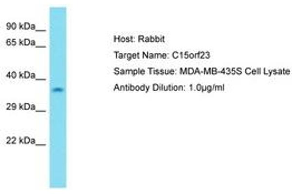 KNSTRN antibody  (AA 31-80)