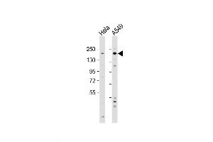 Western Blot at 1:2000 dilution Lane 1: Hela whole cell lysate Lane 2: A549 whole cell lysate Lysates/proteins at 20 ug per lane. (IGF1R antibody  (N-Term))