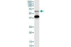 RAGE anticorps  (AA 1-404)