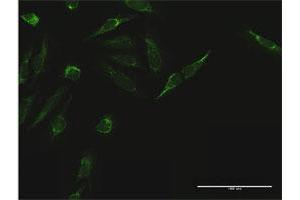 Immunofluorescence of purified MaxPab antibody to TIMM44 on HeLa cell.