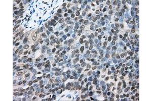 Immunohistochemical staining of paraffin-embedded Kidney tissue using anti-CYP1A2 mouse monoclonal antibody.