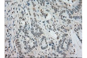 Image no. 1 for anti-Budding Uninhibited By Benzimidazoles 1 Homolog beta (Yeast) (BUB1B) antibody (ABIN1497000) (BUB1B antibody)